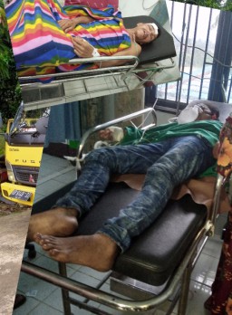 Laka Lantas"Dump Truk Berpenumpang 17 Orang Mengakibatkan Dua Orang Korban Kritis