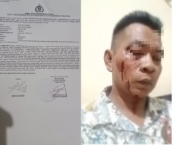 2 Oknum Guru Ngaji Lakukan Pengeroyokan Brutal Terhadap Wartawan Sumenep