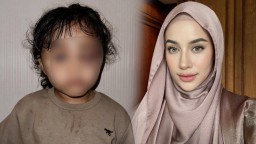 Selebgram Asal Malang Emy Aghnia Ungkap Penganiayaan Sang Anak oleh Suster, Kasus Ditangani Pihak Berwenang