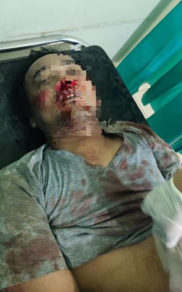 Pengendara Motor Terjatuh Hingga Tewas Akibat Jalan Licin Yang Sebabkan Galian Tanah Merah Milik CV. Elking