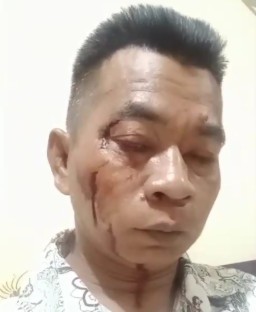 Polres Sumenep Diduga Rekayasa Terlapor Disetting Laporan Balik Pada Kasus Pengeroyokan Wartawan