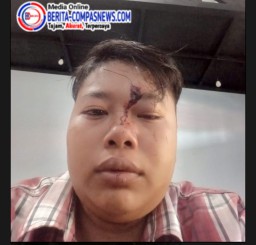 Merasa Dianiaya, Seorang Perempuan Laporkan Petugas Satpol PP ke Polres Sampang