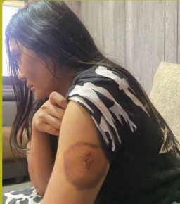 KDRT Terhadap Istri Siri, Anggota DPRD Sampang Dilaporkan ke Kepolisian