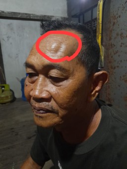 Dituding Memblokir Gaji Tunjangan Anaknya, Seorang Oknum Guru SDN Penjalaan Aniaya Pamannya Sendiri