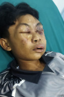 Dugaan Kekerasan Santri di Ponpes Labbaik Indonesia Kubu Raya, Wajah Lebam Disebut Alergi Paracetamol
