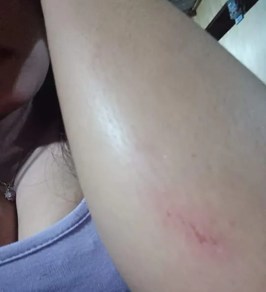 Gara-Gara Cemburu Oknum Kades Terpilih Tampar Cewek di Cafe Remang-Remang