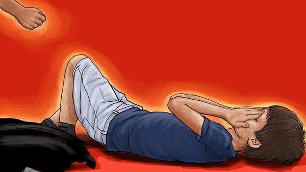 Pondok Pesantren di Kabupaten Malang Diguncang Kasus Bullying, Santri 16 Tahun Alami Luka Bakar