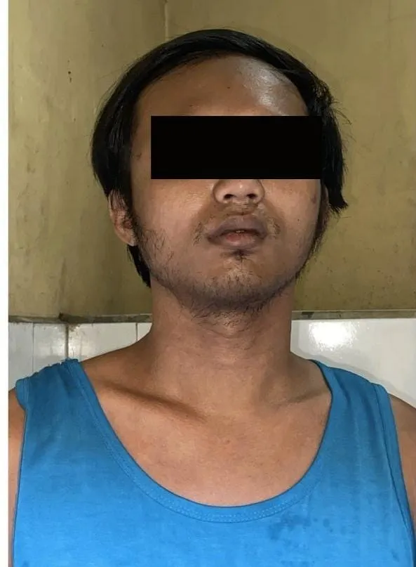Polisi Amankan Pemuda Karang Tembok Curi Cincin Kawin dan Jam Tangan Lewat Jendela Rumah