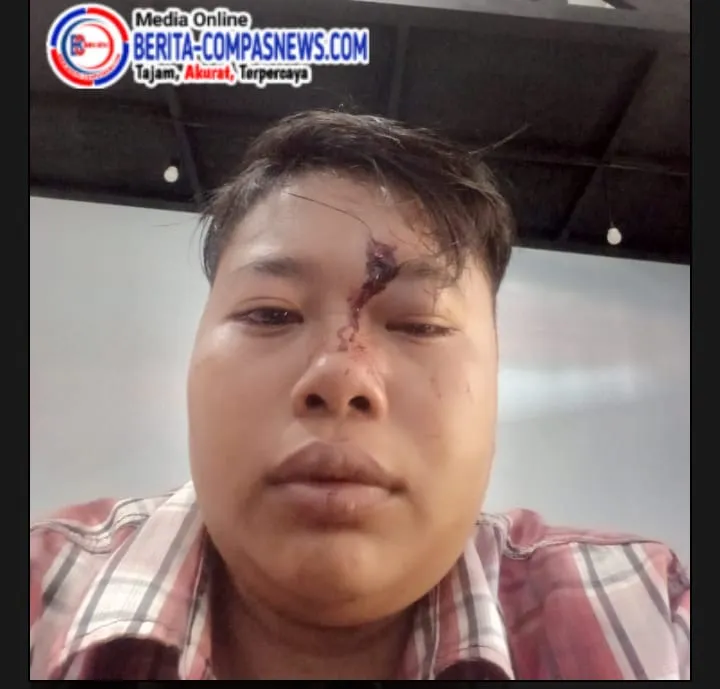 Merasa Dianiaya, Seorang Perempuan Laporkan Petugas Satpol PP ke Polres Sampang