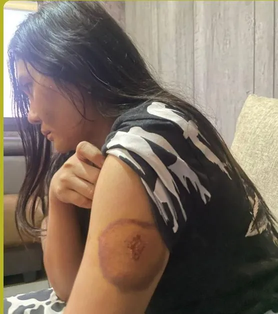 KDRT Terhadap Istri Siri, Anggota DPRD Sampang Dilaporkan ke Kepolisian