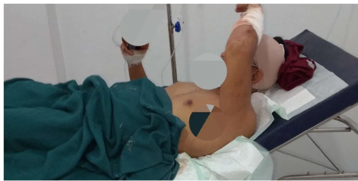 Pembacokan Wartawan di Tuban Harus di Usut Tuntas. APH Segera Tangkap Oknum Preman 