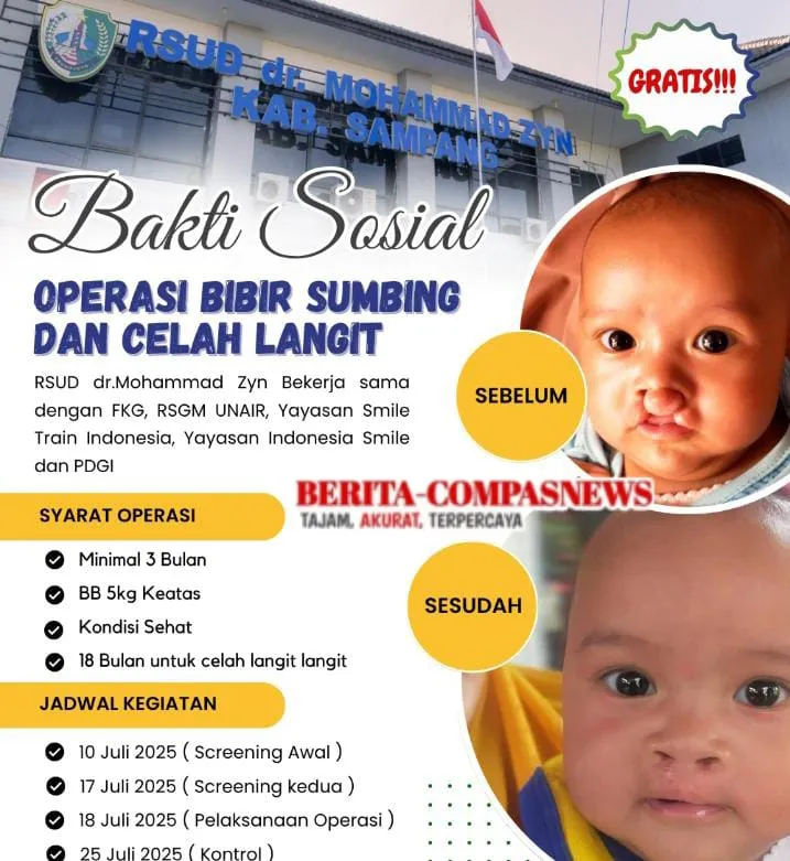 RSUD dr. Muhammad Zyn Sampang Gelar Bakti Sosial Bibir Sumbing