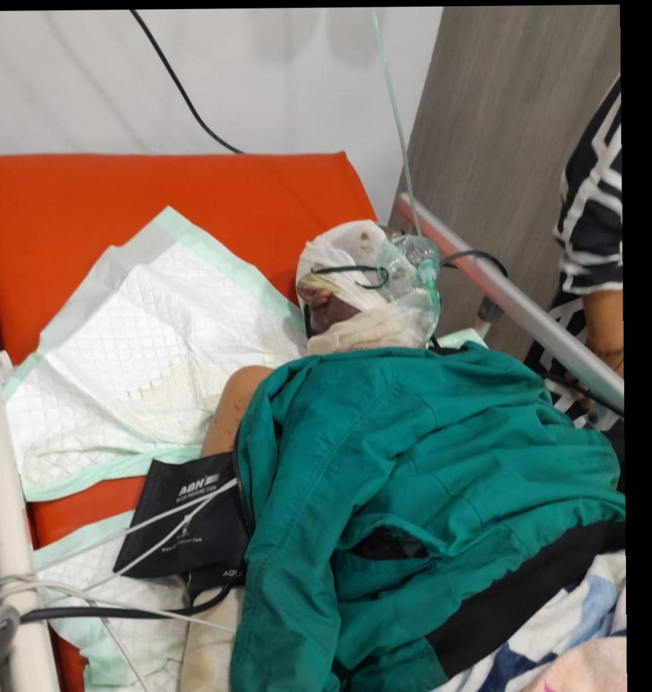 Ledakan LPG di Kapas Madya Surabaya, Dua Korban Kritis; Dugaan Gas Ilegal Diselidiki